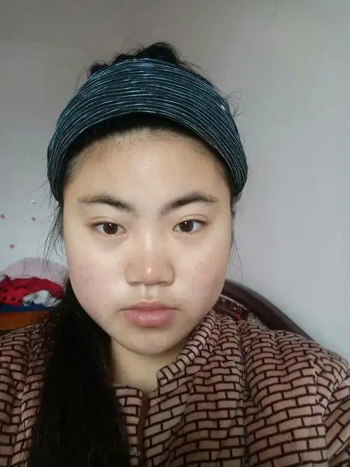 素颜这皮肤会感觉很差吗