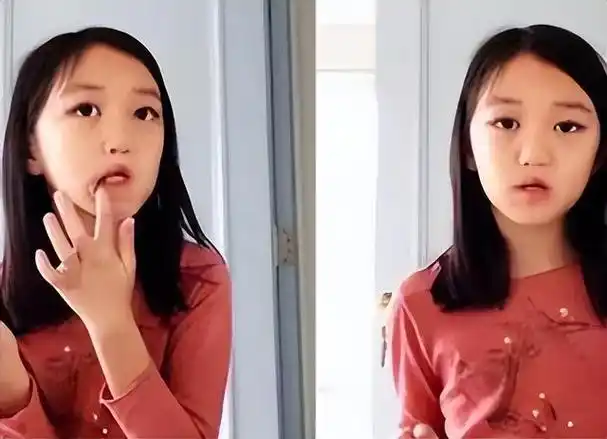 花百万做手术的王菲女儿嘴是治好了但脸却越来越奇怪