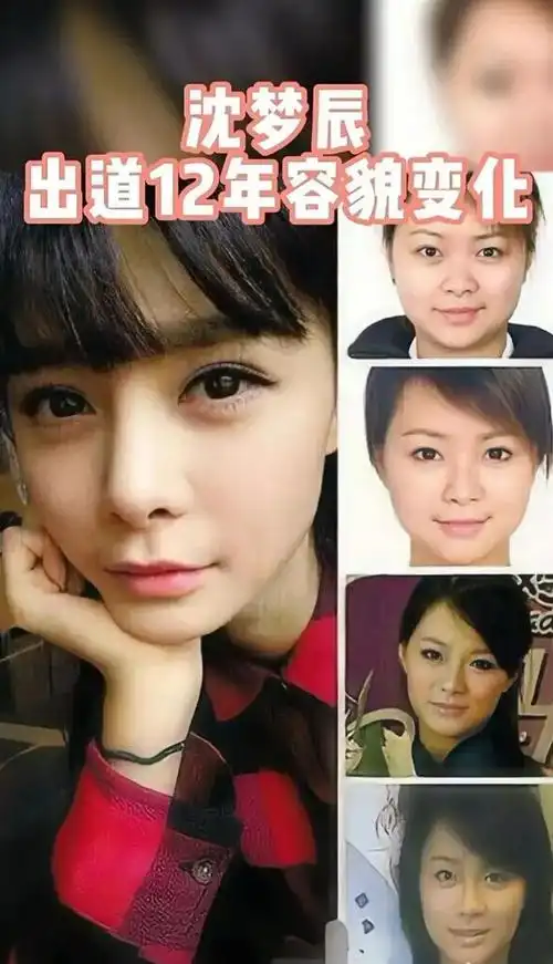 沈梦辰出道至今变化史堪称换头术这才叫教科书级整容