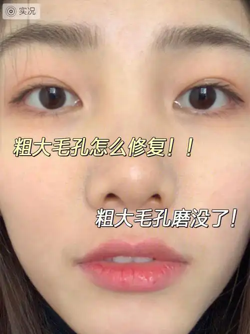 夏季收缩毛孔真相了你想收缩毛孔吗