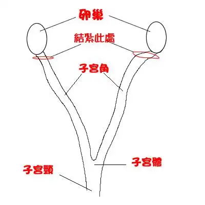 为什么宠物不能做结扎只能做绝育?