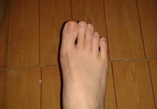 老话说二拇脚趾头长不孝顺爹和娘脚趾和孝顺有何关系