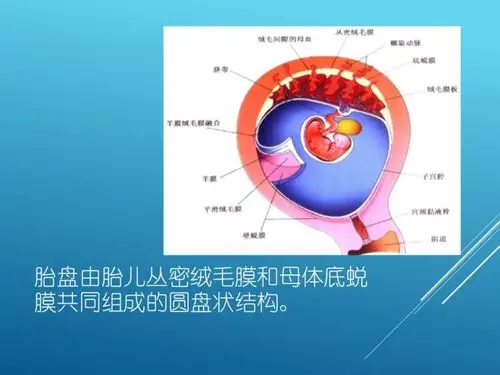 这是胎盘的一个大体示意图,我们需要明白 胎盘的构成,是胎儿绒毛膜和