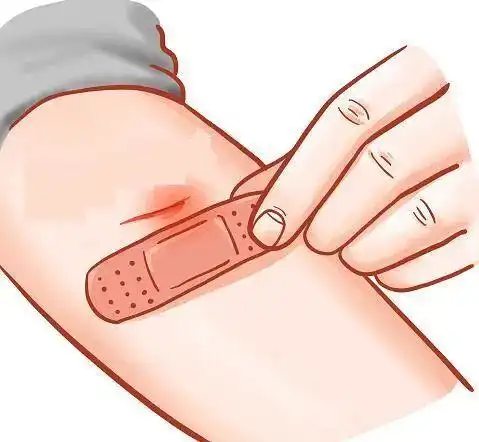 小小的创口贴,学问可不少