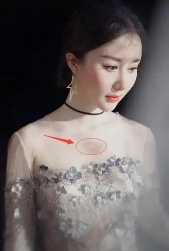 30岁的舒畅美若天仙穿搭仙气十足网友胸口的伤疤怎么回事