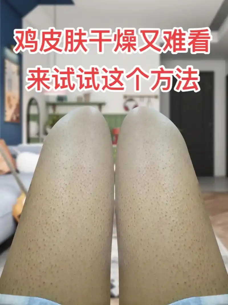 鸡皮肤 干燥又难看,来试试这个方法!#维e乳和尿素霜 ,你 - 抖音
