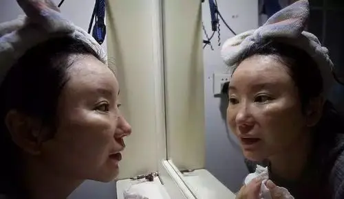 图片来源:网络整容变毁容花费近17w的陈怡丽术后鼻子发炎及畸形不对称