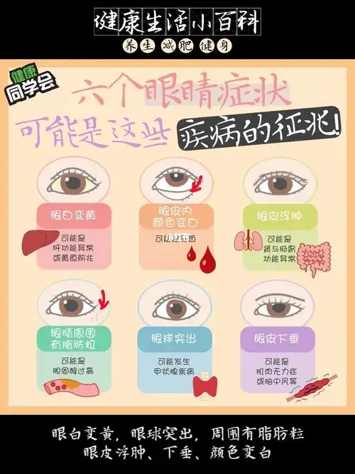 要当心疾病萌芽_养生_眼睛健康_眼睛干涩_健康生活_贫血_眼睛_医疗