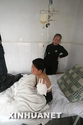 2月25日,被狮子咬伤的男孩接受了左臂截肢手术.