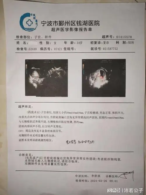 怀孕后需要做哪些检查是在怀孕的血检与宫外孕出血的关系病危单