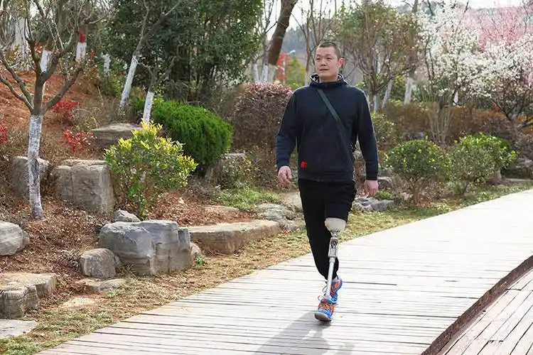 大腿假肢的工作原理与制作方法(一)