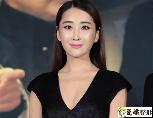 杜若溪,整容前,照片