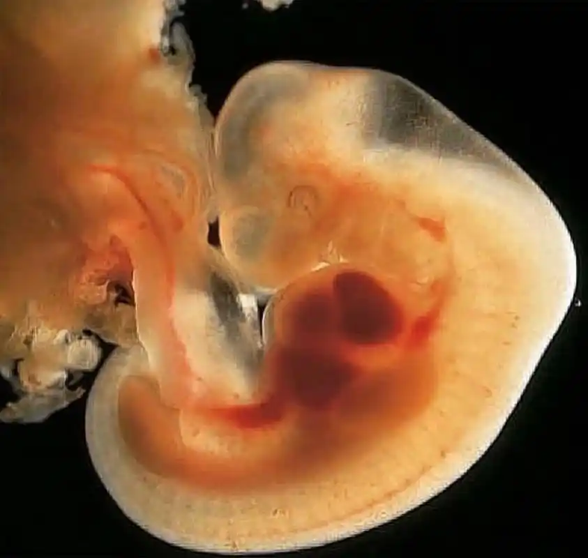 怀孕50多天胎儿是什么样?孕妈做好4点,避开胎停流产和胎儿畸形