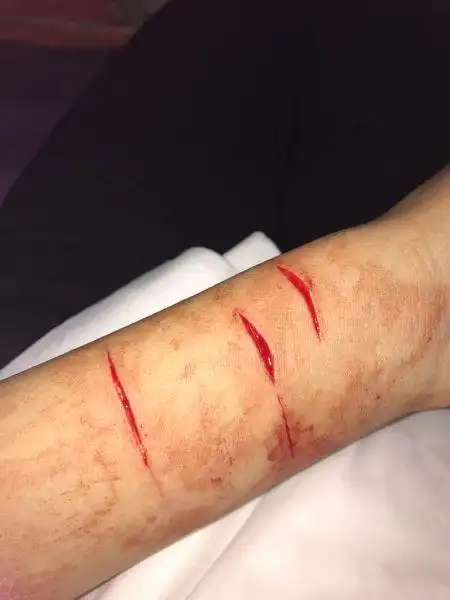 发布于59 分钟前   最佳答案 这个问题比较幼稚 当初割的时候咋不