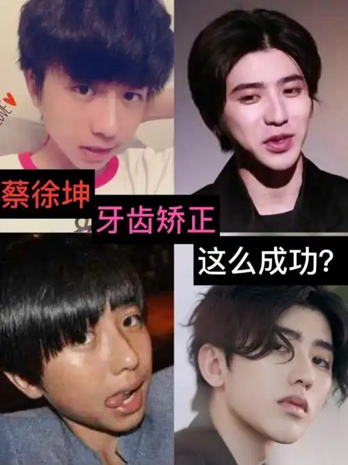 蔡徐坤,最近这段时间在网络上备受大家的关注,因为在_圈子-新氧美容