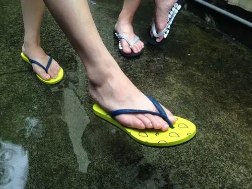 喜欢穿「人字拖」的朋友注意⚠医生:拖鞋最好不要穿超过半天❗不