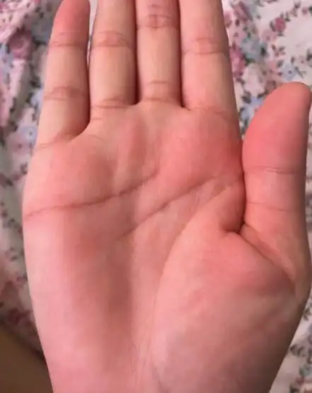 女人手相此处断开,必定有意外事故