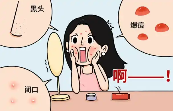 脸上出现闭口不用慌,做好清洁配合刷酸,也能还原肌肤亮泽