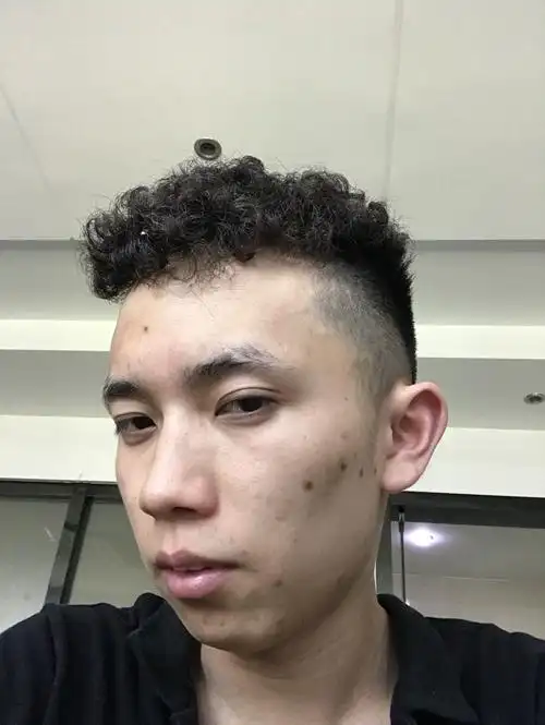 如图皮肤暗黄阴沉是什么引起的?