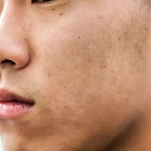 美白精华即便没有立即美白的效果,但是皮肤一定会有变化!