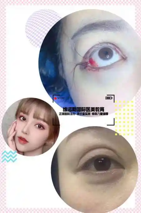 成都微整形学费价格表的