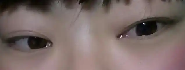 今天早上起来眼睛流眼泪,但是不是哭,而且止不住的流,我就用手擦,没擦