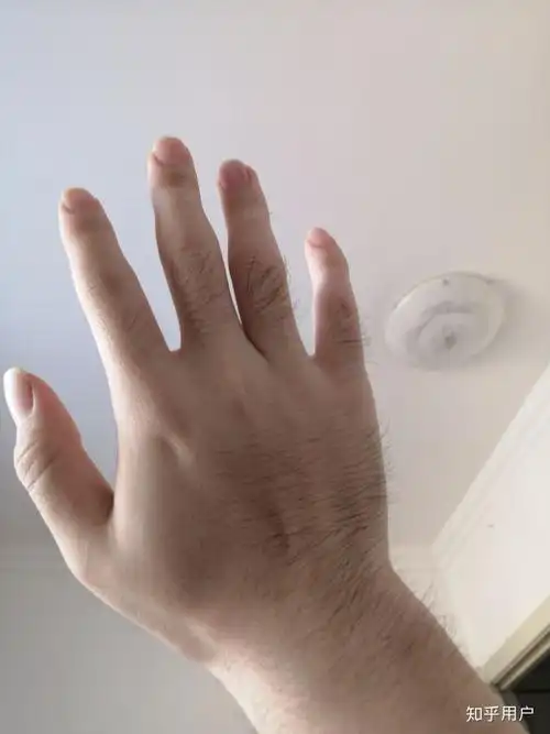 手指上长毛是一种什么样的体验