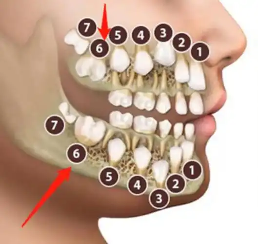 "六龄齿"长在哪里?