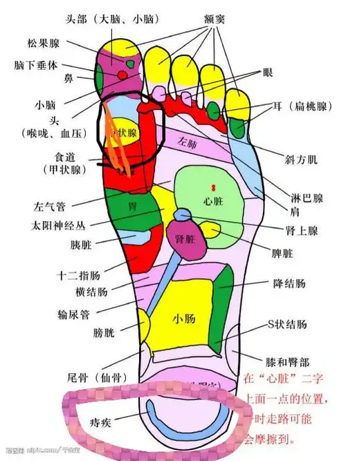 右脚掌疼(就是我在图里圈的部位-痔疾),请问怎么办?要如何治好?