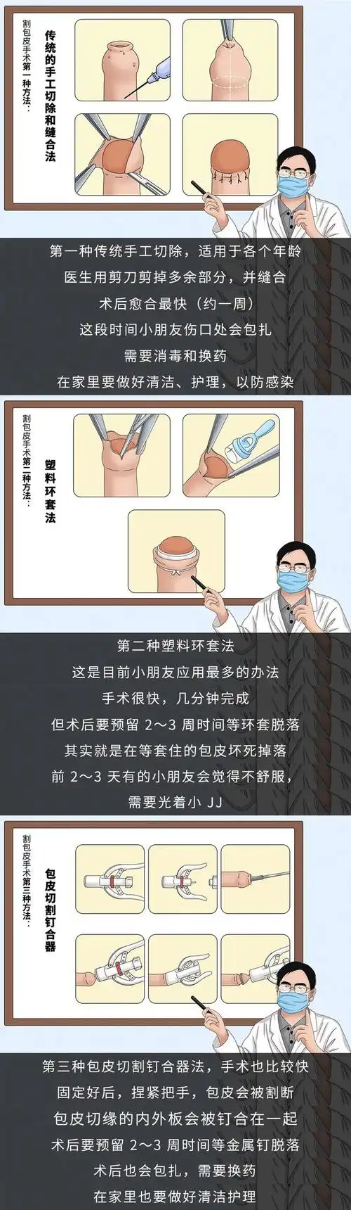 钦仰!男孩包皮发育过程"长话短说"-第1张图片-杰浩网