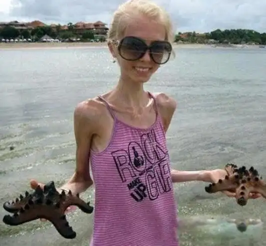 世界上最瘦的女人是谁kseniyabubenko皮包骨头的图片