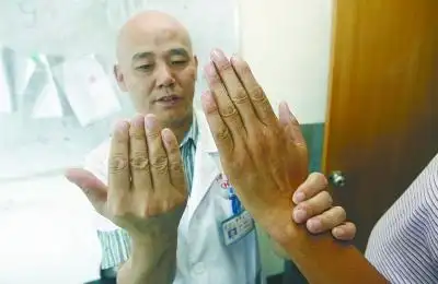 长手长脚,还戴着一副眼镜——他叫吕世威,安陆人,典型的马凡氏综合症