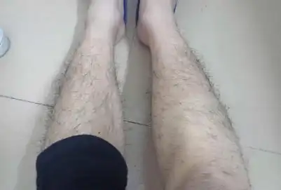 腿毛种植怎么样 如何选择腿毛种植医院