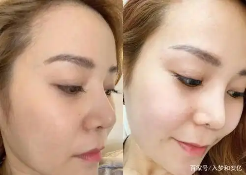 安杰拉vs瞬美优品补水美白产品使用效果对比