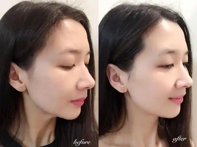 冬季护肤好物推荐,帮你养成水感靓白baby肌