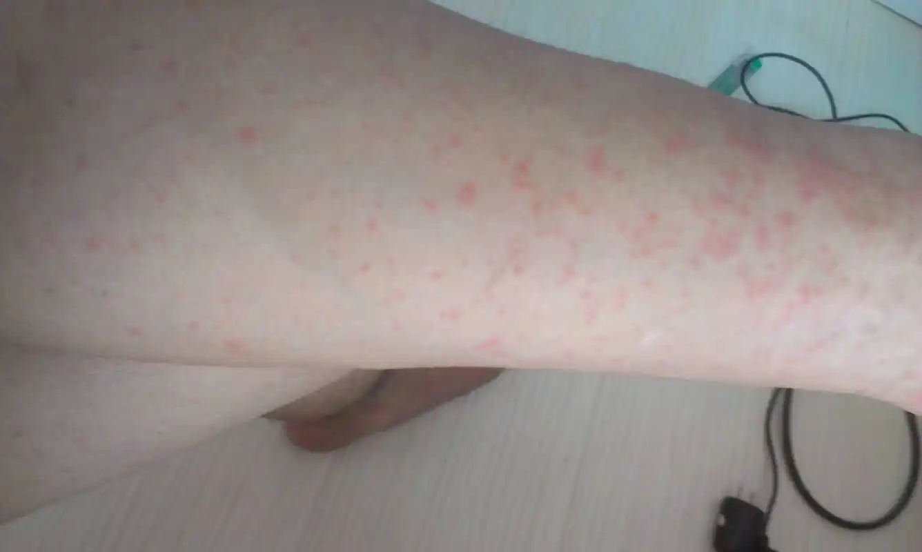 中老年人容易皮肤瘙痒,5个"罪魁祸首",医生:这些习惯要改