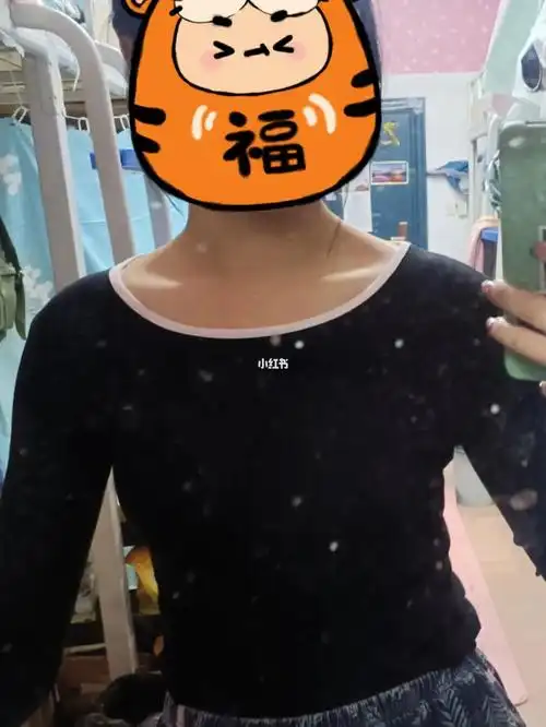 这斜方肌严重吗