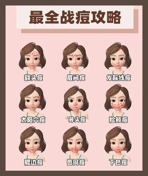 如何正确祛痘印63对症下药恢复陶瓷肌