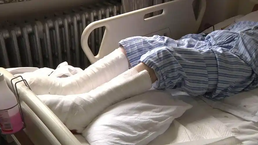 夏伯渝回忆双腿冻伤截肢经历看到皮肤变色就有心理准备了