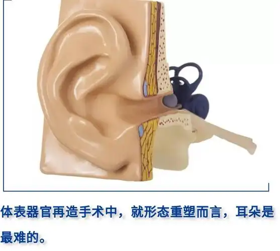 小耳症那些事儿(二十四)再造耳朵的相似度