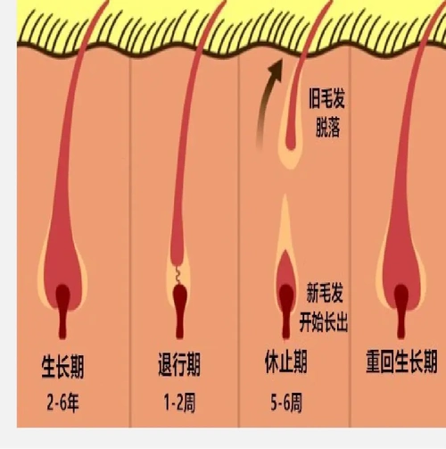 拔白发,会对毛囊造成损伤吗? - 蒙霸养发