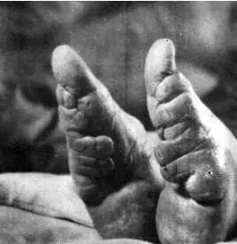 实拍三寸金莲裹脚缠足全过程图