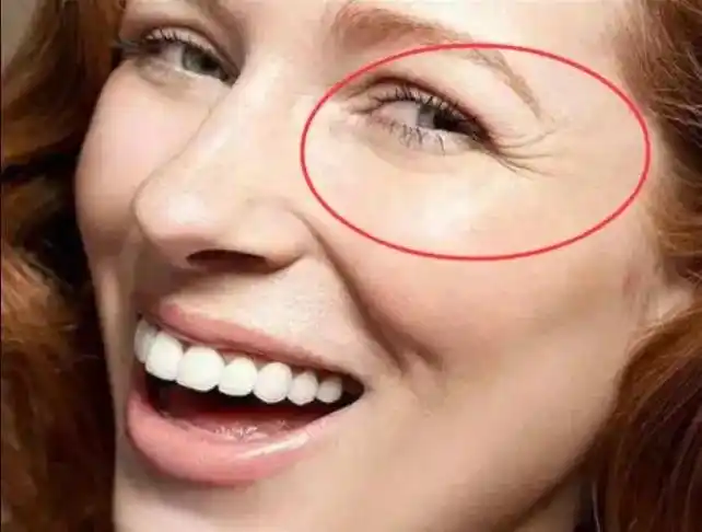 脸部衰老的表现有哪些