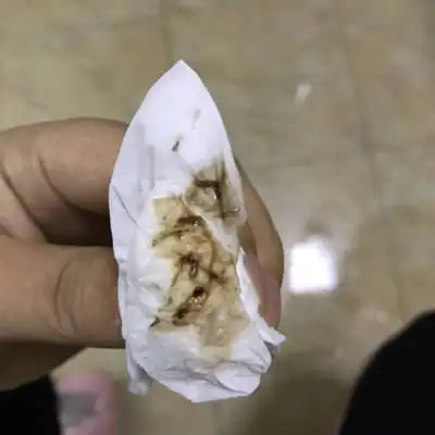 我怀孕5到6周,下面有褐色分泌物,昨天去医院拿了胞胎灵和黄体酮胶囊