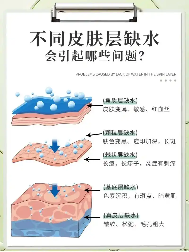 你的皮肤缺水了吗?#护肤小常识 #美容皮肤管理 #好皮肤养成 - 抖音