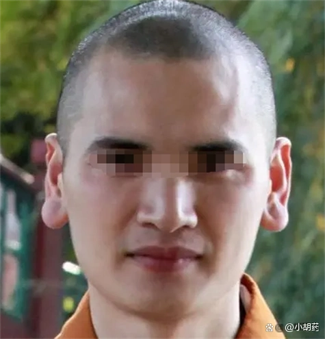 "穷人耳","富人耳",是什么原因导致了耳朵形态各异呢?