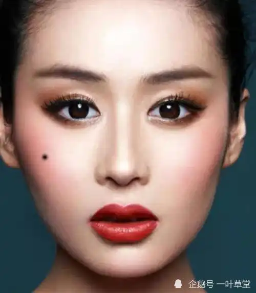 额头有痣与亲人之间的缘份较浅,离家在外的机会很多,也很难受到晚辈