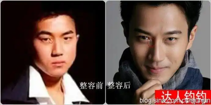 爆红刘恺威整容对比照全曝光(组图)