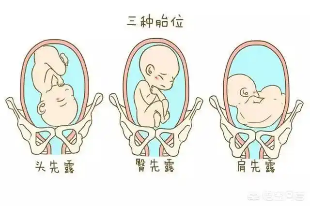 头条问答 - 胎心在肚脐左下方是什么胎位?(10个回答)
