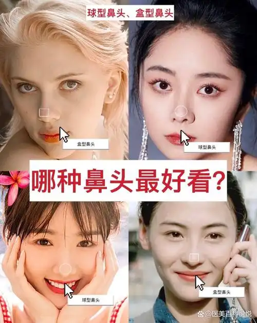 除了山根,鼻翼是决定鼻部好看的因素,鼻头的形态也是直接影响了鼻子的